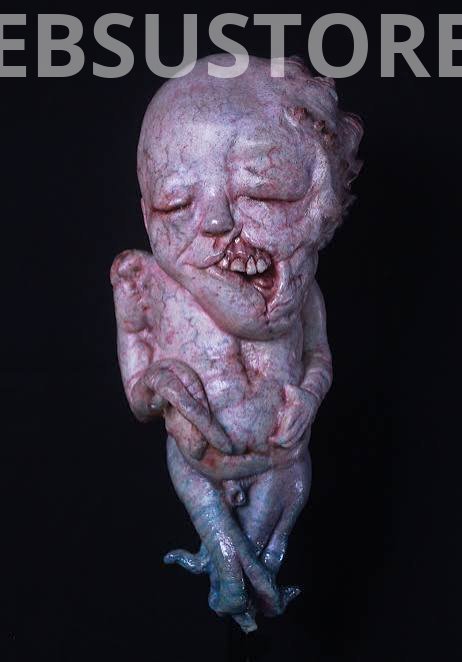 Deformities in Children: Understanding Genetic and Congenital Conditions Beyond Superstition